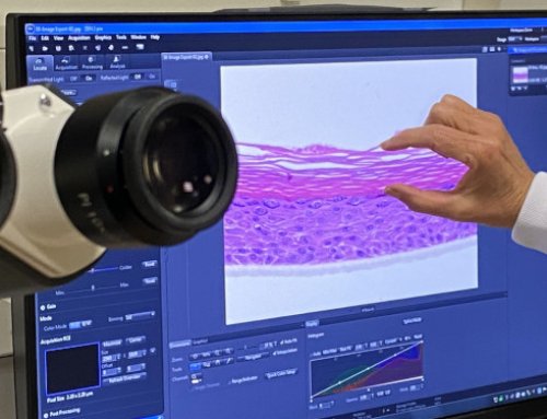 Decoding Skin Resilience